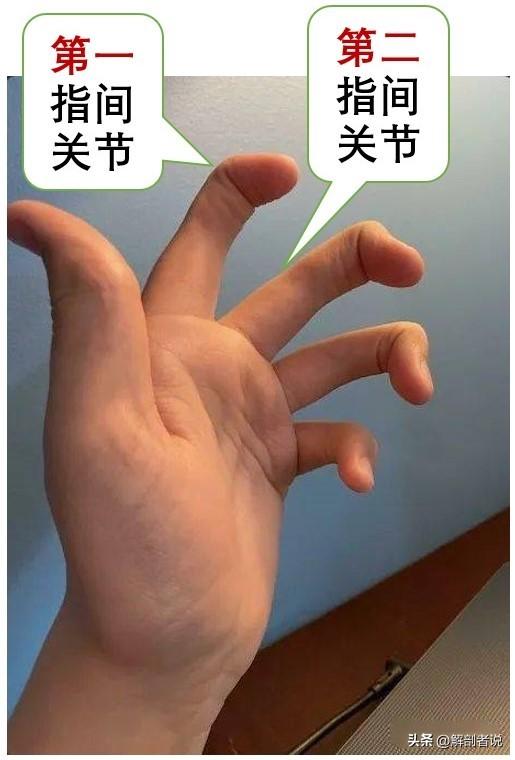 各手指解剖图及名称(白话解剖奇怪的手指)(10)