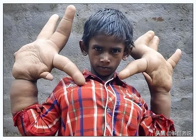 各手指解剖图及名称(白话解剖奇怪的手指)(2)