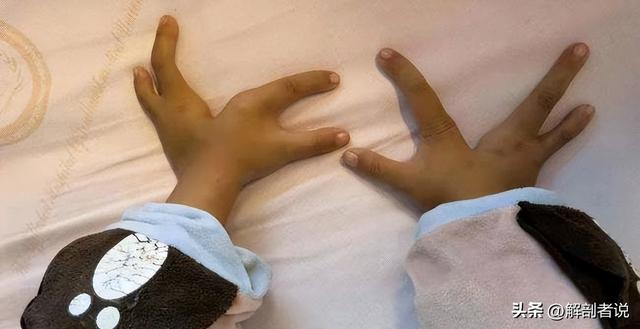 各手指解剖图及名称(白话解剖奇怪的手指)(7)