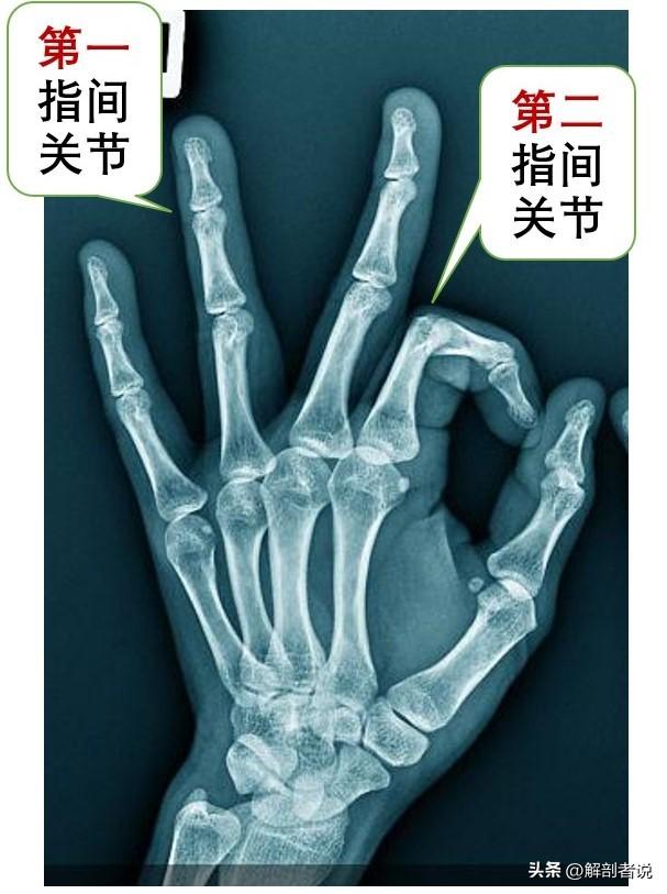 各手指解剖图及名称(白话解剖奇怪的手指)(11)