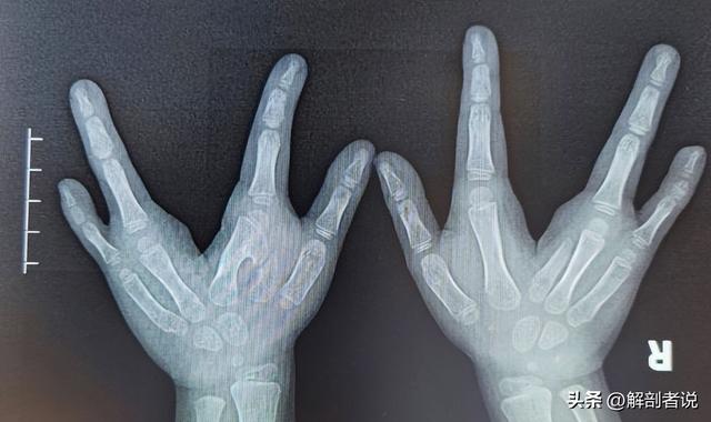 各手指解剖图及名称(白话解剖奇怪的手指)(8)