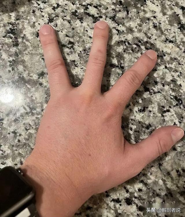 各手指解剖图及名称(白话解剖奇怪的手指)(5)