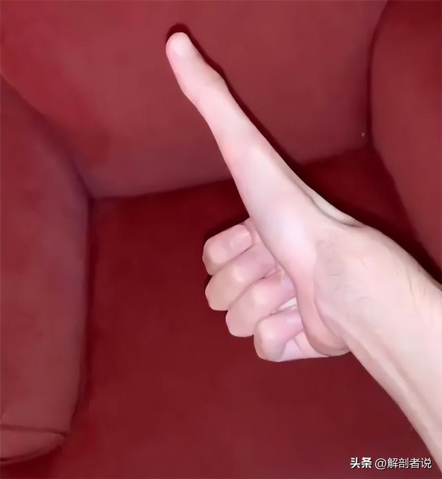 各手指解剖图及名称(白话解剖奇怪的手指)(3)