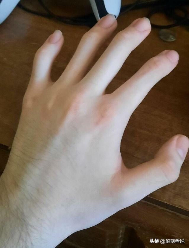 各手指解剖图及名称(白话解剖奇怪的手指)(12)