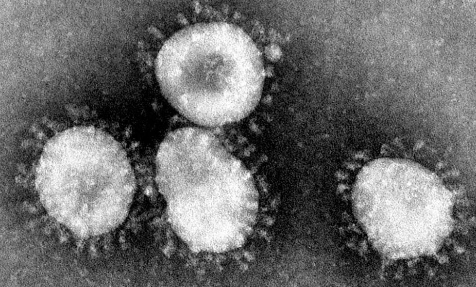 病毒存在34亿年（病毒存在多少亿年了）