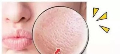 ​如何彻底去黑头收缩毛孔(怎么去黑头收缩毛孔小妙招)