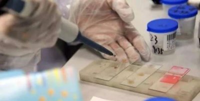 ​医院捐精的过程原来是这样的