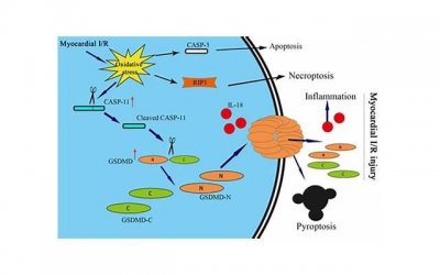 ​心肌缺血的六个征兆，了解心肌缺血的六大症状