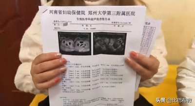 ​十八岁八胞胎母亲奋力生子的背后，究竟还隐藏着什么？