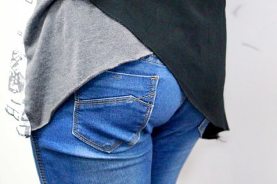 ​痔疮是什么 痔疮有哪些具体表现？患上痔疮，怎么做才能好得快？