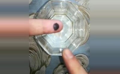 ​手上血泡怎样处置，小血泡吃消炎药（大血泡用针挑破）