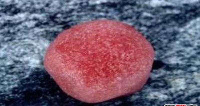 ​西瓜雪是怎样回事？西瓜雪不妨吃吗_不妨